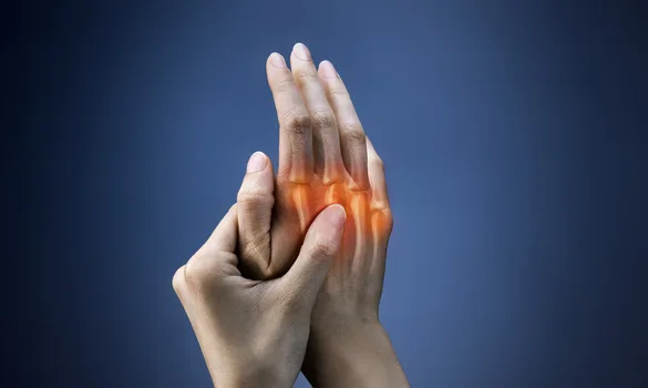 Educational image associated with Rheumatoid Arthritis